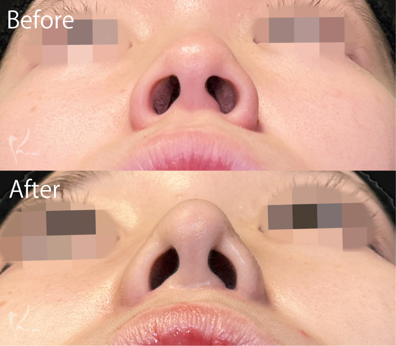 症例2写真2枚目