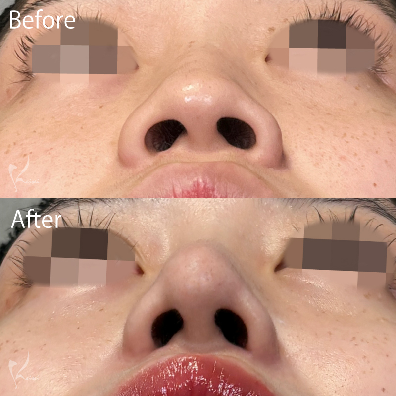 症例3写真2枚目