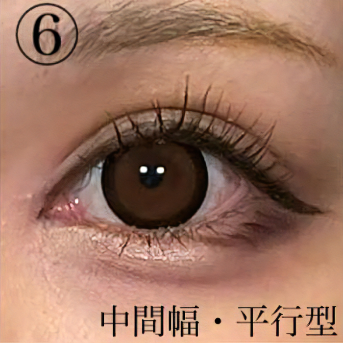 中間幅×平行型の写真