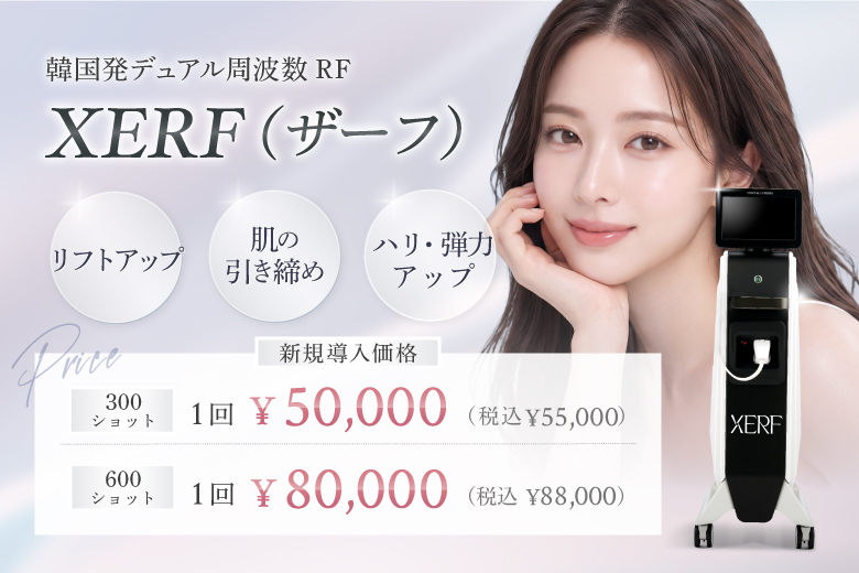 XERF（ザーフ）