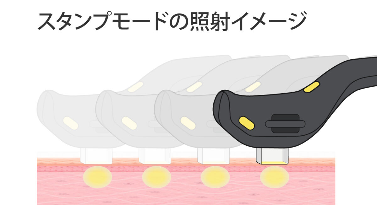 フォトフェイシャル ステラM22 XPL スタンプモードの照射イメージ