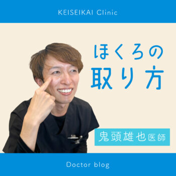 気になるホクロの取り方！